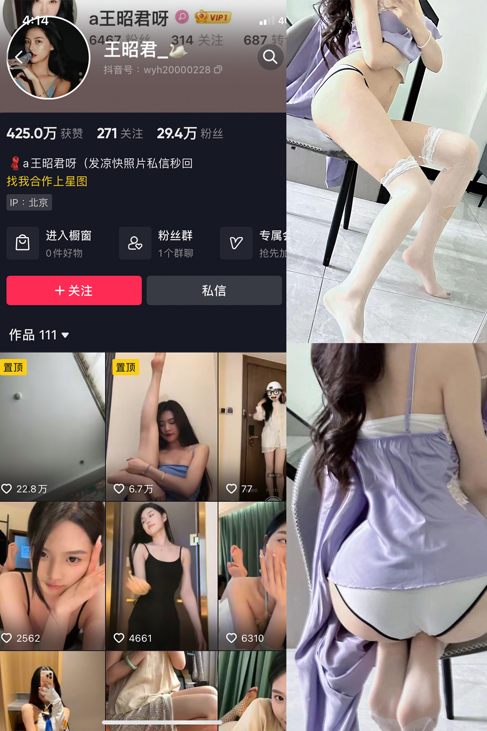 图片[1]-抖音 王昭君 微密圈  NO.012期 【13P】最新至：2023.6.13-微密空间-全网最全抖音网红铁粉空间觅圈